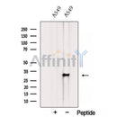 Western blot analysis of extracts from A549 cells, using TMEM106B Antibody. The lane on the left was treated with blocking peptide.