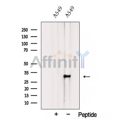 Western blot analysis of extracts from A549 cells, using TMEM106B Antibody. The lane on the left was treated with blocking peptide.