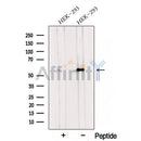Western blot analysis of extracts from HEK-293 cells, using TMEM175 Antibody. The lane on the left was treated with blocking peptide.