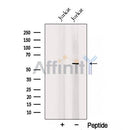 Western blot analysis of extracts from Jurkat cells, using TRAF5 Antibody. The lane on the left was treated with blocking peptide.