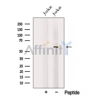 Western blot analysis of extracts from Jurkat cells, using TRAF5 Antibody. The lane on the left was treated with blocking peptide.