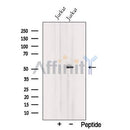 Western blot analysis of extracts from Jurkat cells, using TRIM15 Antibody. The lane on the left was treated with blocking peptide.