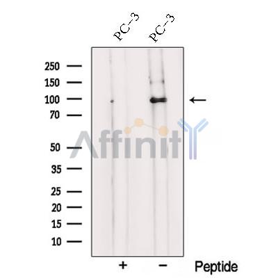 Western blot analysis of extracts from PC-3 cells, using TRPC1 Antibody. The lane on the left was treated with blocking peptide.