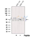 Western blot analysis of extracts from HEK-293 cells, using TSP50 Antibody. The lane on the left was treated with blocking peptide.