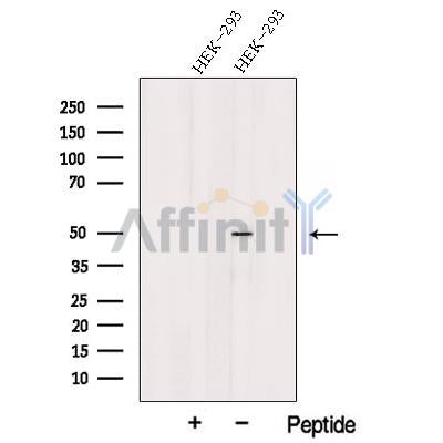 Western blot analysis of extracts from HEK-293 cells, using TSP50 Antibody. The lane on the left was treated with blocking peptide.