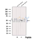 Western blot analysis of extracts from Mouse spleen  tissue, using TTRAP Antibody. The lane on the left was treated with blocking peptide.