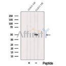 Western blot analysis of extracts from COLO 320 cells, using TXNDC5 Antibody. The lane on the left was treated with blocking peptide.