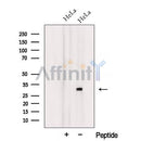 Western blot analysis of extracts from HeLa cells, using TXNL6 Antibody. The lane on the left was treated with blocking peptide.