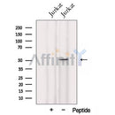 Western blot analysis of extracts from Jurkat cells, using UMPS Antibody. The lane on the left was treated with blocking peptide.