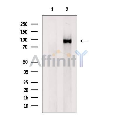 Western blot analysis of extracts from HepG2 cells, using VPS35 Antibody. The lane on the left was treated with blocking peptide.