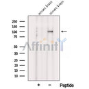 Western blot analysis of extracts from Mouse brain tissue, using VPS39 Antibody. The lane on the left was treated with blocking peptide.
