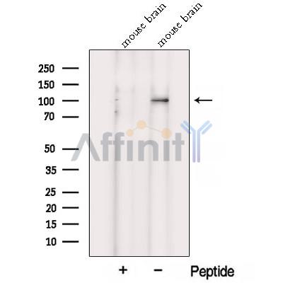 Western blot analysis of extracts from Mouse brain tissue, using VPS39 Antibody. The lane on the left was treated with blocking peptide.