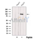 Western blot analysis of extracts from HepG2 cells, using VPS41 Antibody. The lane on the left was treated with blocking peptide.