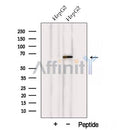 Western blot analysis of extracts from HepG2 cells, using VPS45 Antibody. The lane on the left was treated with blocking peptide.