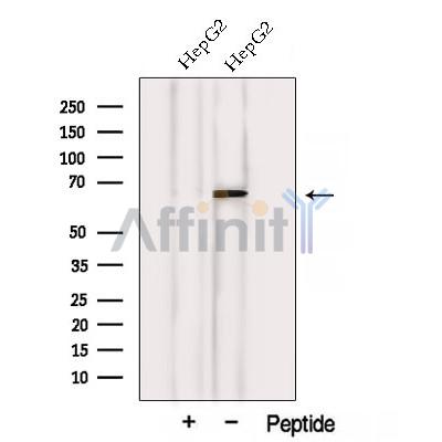 Western blot analysis of extracts from HepG2 cells, using VPS45 Antibody. The lane on the left was treated with blocking peptide.