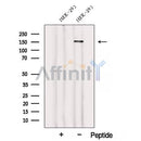 Western blot analysis of extracts from HEK-293 cells, using WDR19/IFT144 Antibody. The lane on the left was treated with blocking peptide.