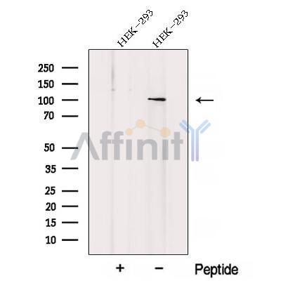 Western blot analysis of extracts from Rat  liver, using ZHX1 Antibody. The lane on the left was treated with blocking peptide.