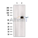 Western blot analysis of extracts from Mouse brain tissue?, using ZNF238 Antibody. The lane on the left was treated with blocking peptide.