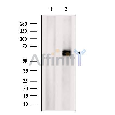 Western blot analysis of extracts from Mouse brain tissue?, using ZNF238 Antibody. The lane on the left was treated with blocking peptide.