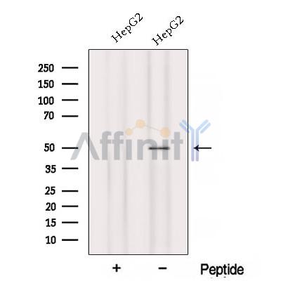 Western blot analysis of extracts from HepG2 cells, using AADAT Antibody. The lane on the left was treated with blocking peptide.