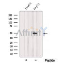 Western blot analysis of extracts from Rat  heart, using ACADL Antibody. The lane on the left was treated with blocking peptide.