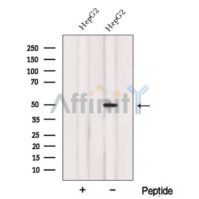 Western blot analysis of extracts from Rat  heart, using ACADL Antibody. The lane on the left was treated with blocking peptide.