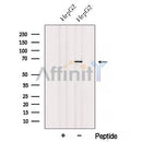 Western blot analysis of extracts from Rat  brain, using ACSM3 Antibody. The lane on the left was treated with blocking peptide.