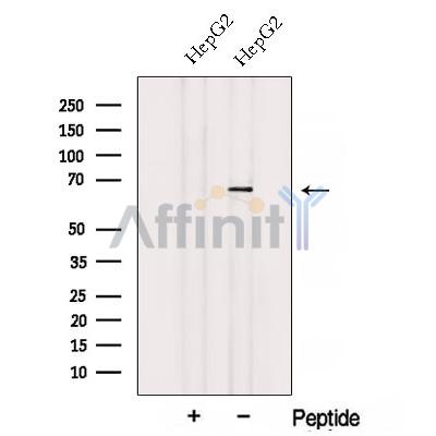 Western blot analysis of extracts from Rat  brain, using ACSM3 Antibody. The lane on the left was treated with blocking peptide.