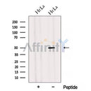 Western blot analysis of extracts from HeLa cells, using ADIPOR2 Antibody. The lane on the left was treated with blocking peptide.