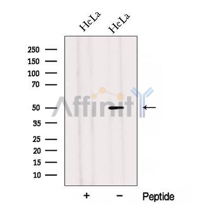 Western blot analysis of extracts from HeLa cells, using ADIPOR2 Antibody. The lane on the left was treated with blocking peptide.