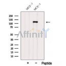 Western blot analysis of extracts from MCF-7 cells, using AFAP1 Antibody. The lane on the left was treated with blocking peptide.