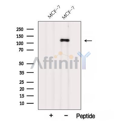 Western blot analysis of extracts from MCF-7 cells, using AFAP1 Antibody. The lane on the left was treated with blocking peptide.