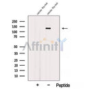 Western blot analysis of extracts from Mouse thymus tissue, using AFAP1L2 Antibody. The lane on the left was treated with blocking peptide.