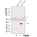 Western blot analysis of extracts from Mouse liver tissue?, using AFMID Antibody. The lane on the left was treated with blocking peptide.