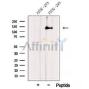 Western blot analysis of extracts from MCF7, using AHI1 Antibody. The lane on the left was treated with blocking peptide.