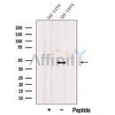 Western blot analysis of extracts from SH-SY5Y cells, using AIPL1 Antibody. The lane on the left was treated with blocking peptide.