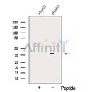 Western blot analysis of extracts from HepG2 cells, using AKR7A3 Antibody. The lane on the left was treated with blocking peptide.