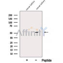 Western blot analysis of extracts from various samples, using ALDH5A1 Antibody.
 Lane 1: B16F10, treated with blocking peptide;
 Lane 2: B16F10;
 Lane 3: Rat  brain.