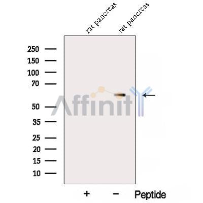 Western blot analysis of extracts from Rat pancreas? tissue, using Amylase,alpha Antibody. The lane on the left was treated with blocking peptide.