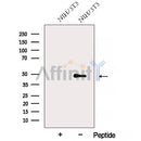 Western blot analysis of extracts from NIH/3T3 cells, using AP3M1 Antibody. The lane on the left was treated with blocking peptide.