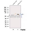 Western blot analysis of extracts from HepG2, using APPBP1 Antibody. The lane on the left was treated with blocking peptide.