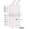 Western blot analysis of extracts from Rat  kidney, using ARD1B Antibody. The lane on the left was treated with blocking peptide.
