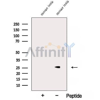 Western blot analysis of extracts from Rat  kidney, using ARD1B Antibody. The lane on the left was treated with blocking peptide.
