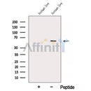 Western blot analysis of extracts from Human liver tissue, using ARHGAP15 Antibody. The lane on the left was treated with blocking peptide.