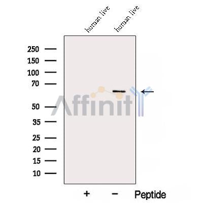 Western blot analysis of extracts from Human liver tissue, using ARHGAP15 Antibody. The lane on the left was treated with blocking peptide.