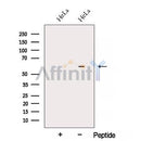 Western blot analysis of extracts from MCF7, using ARIH2 Antibody. The lane on the left was treated with blocking peptide.