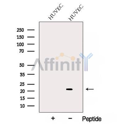 Western blot analysis of extracts from HUVEC cells, using ARL4C Antibody. The lane on the left was treated with blocking peptide.