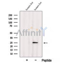 Western blot analysis of extracts from Human liver tissue, using ARL5B Antibody. The lane on the left was treated with blocking peptide.