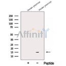 Western blot analysis of extracts from HepG2, using ARMET Antibody. The lane on the left was treated with blocking peptide.