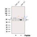 Western blot analysis of extracts from HEK-293 cells, using ARP2 Antibody. The lane on the left was treated with blocking peptide.